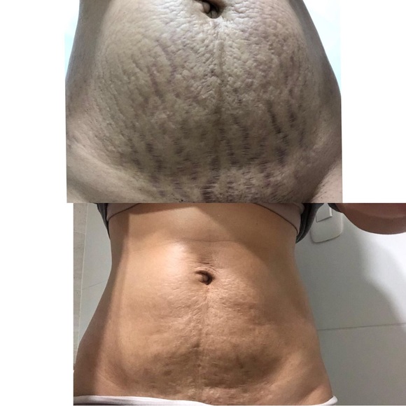 Meet your Posher, MB Distributor, LLC - Picture 16 of 17